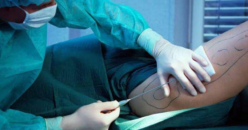 Dok. Verywell Health